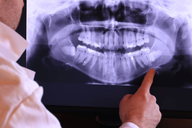 Best Emergency Treatment for Toothache in Eastpoint, FL