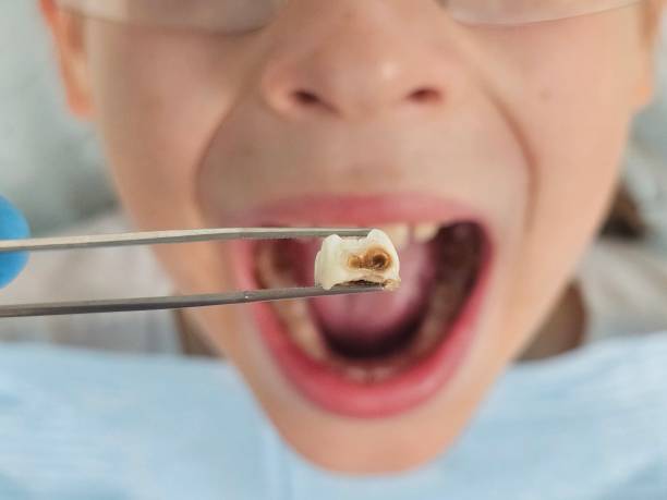 Best Weekend Emergency Dentist in Eastpoint, FL
